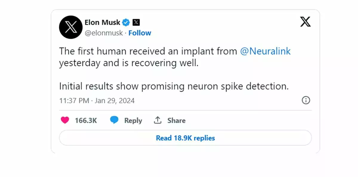 elon musk implant mózgu Neuralink